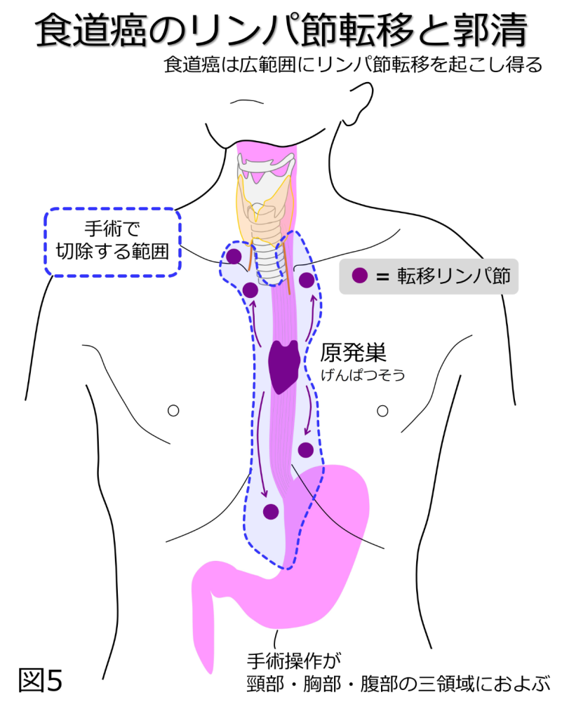 食道 やけど 症状