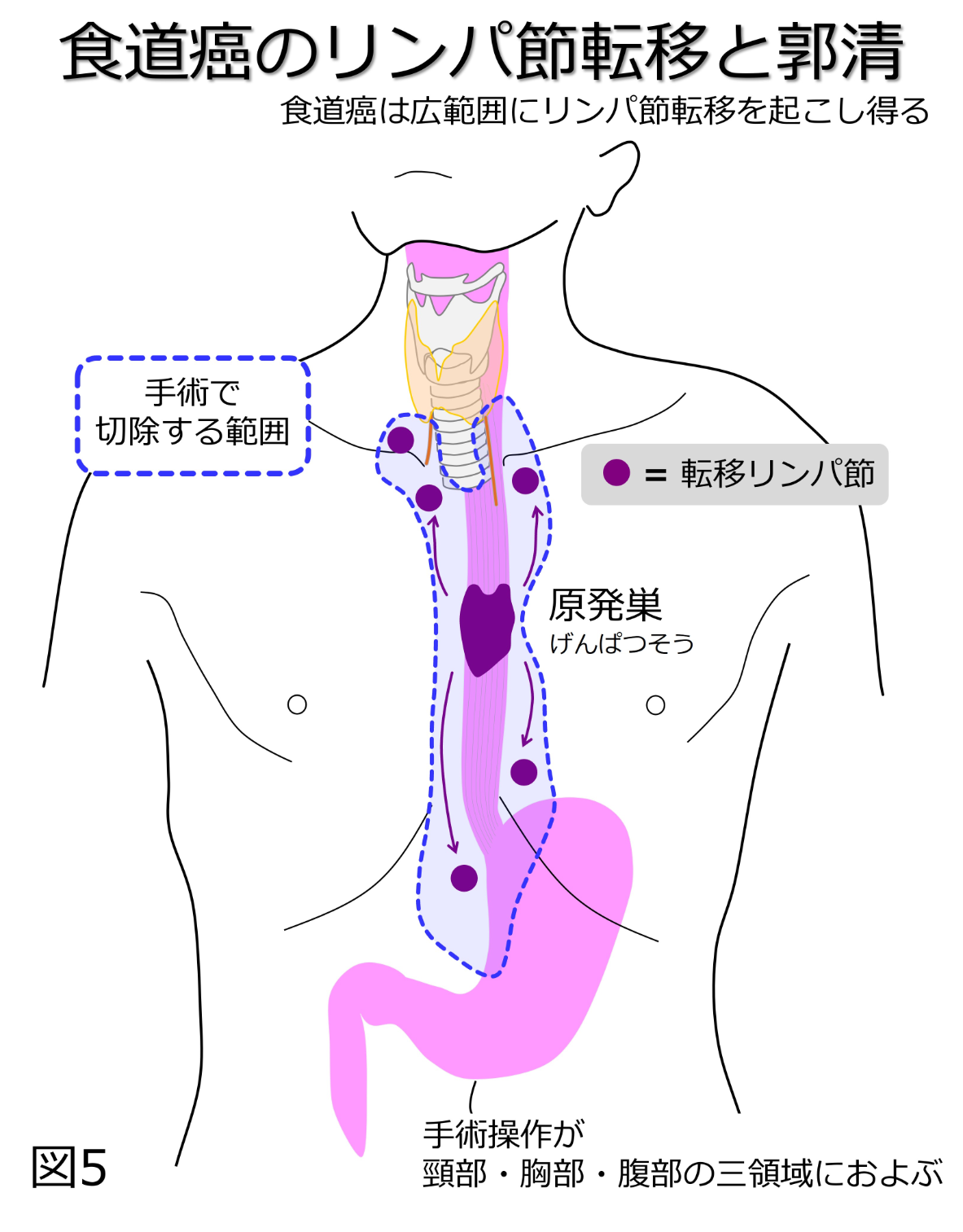 食道 が ん 症状 _ 食道がんの初期症状ってあるの – Refdocsic